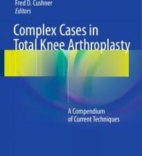 complex cases in total knee arthroplasty: a compendium of current techniques