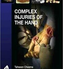 complex injuries of the hand 1st edition