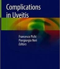 complications in uveitis