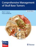 comprehensive management of skull base tumors 2nd edition