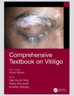 comprehensive textbook on vitiligo 1st edition