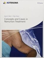 concepts and cases in nonunion treatment (ao trauma handbooks) 1st edition