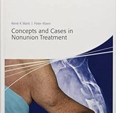 concepts and cases in nonunion treatment (ao trauma handbooks) 1st edition