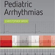 Concise Guide to Pediatric Arrhythmias