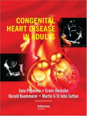 congenital heart disease in adults 1st edition