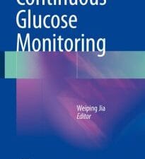 continuous glucose monitoring