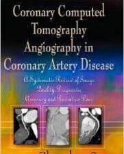 Coronary Computed Tomography Angiography in Coronary Artery Disease: A Systematic Review of Image Quality, Diagnostic Accuracy