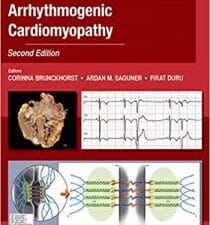 Current Concepts in Arrhythmogenic Cardiomyopathy, Second Edition