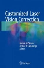 customized laser vision correction