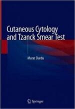 cutaneous cytology and tzanck smear test