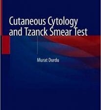 cutaneous cytology and tzanck smear test