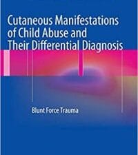 cutaneous manifestations of child abuse and their differential diagnosis: blunt force trauma