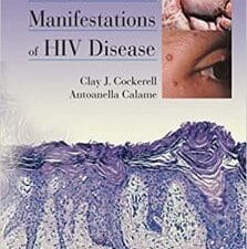 cutaneous manifestations of hiv disease 1st edition