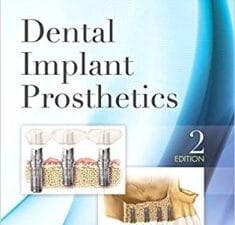 Dental Implant Prosthetics 2nd Edition
