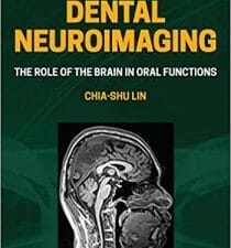 Dental Neuroimaging: The Role of the Brain in Oral Functions 1st Edition