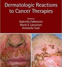 Dermatologic Reactions to Cancer Therapies