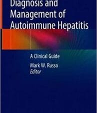 diagnosis and management of autoimmune hepatitis: a clinical guide