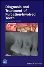 Diagnosis and Treatment of Furcation-Involved Teeth