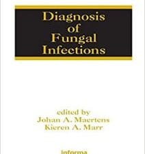 diagnosis of fungal infections (infectious disease and therapy) 1st edition