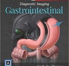 diagnostic imaging: gastrointestinal 3rd edition