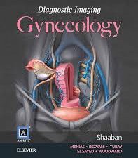 diagnostic imaging: gynecology 2nd edition