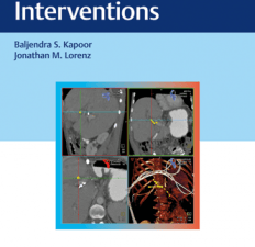digestive disease interventions