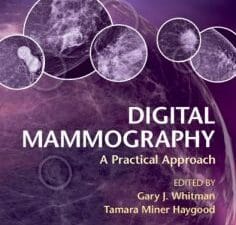 digital mammography: a practical approach