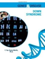 down syndrome (genes & disease)
