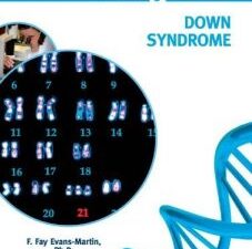 down syndrome (genes & disease)