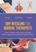 dry needling for manual therapists : points, techniques and treatments
