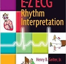 E-Z ECG Rhythm Interpretation First Edition