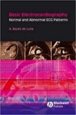 Basic Electrocardiography: Normal and Abnormal ECG Patterns (Blackwell’s At a Glance Series)