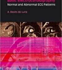 Basic Electrocardiography: Normal and Abnormal ECG Patterns (Blackwell’s At a Glance Series)