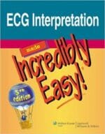 ECG Interpretation Made Incredibly Easy! 5th Edition