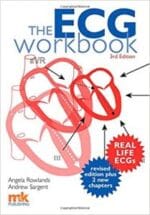 ECG Workbook 3rd
