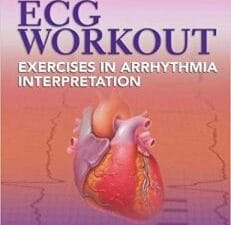 ECG Workout: Exercises in Arrhythmia Interpretation (Huff, ECG Workout) Sixth Edition