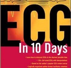 ECG in 10 Days