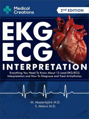 ekg/ecg interpretation: everything you need to know about the 12 lead ecg/ekg interpretation and how to diagnose and treat arrhythmias