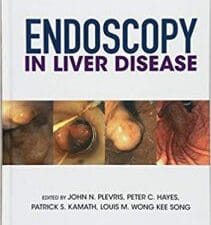 endoscopy in liver disease (december 2017 release)