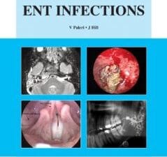 ENT Infections: An Atlas of Investigation and Management