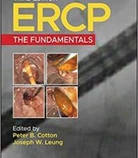 ercp: the fundamentals (3rd edition)