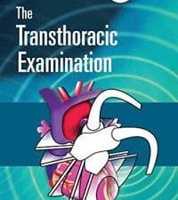 Echocardiography Pocket Guide: The Transthoracic Examination (Echocardiography Pocket Guides)