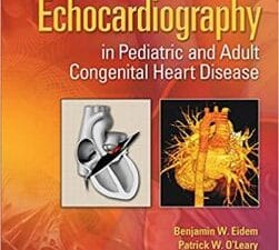 Echocardiography in Pediatric and Adult Congenital Heart Disease 2nd Edition