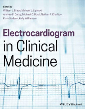 electrocardiogram in clinical medicine