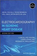 Electrocardiography in Ischemic Heart Disease: Clinical and Imaging Correlations and Prognostic Implications 2nd Edition