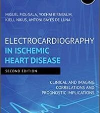 Electrocardiography in Ischemic Heart Disease: Clinical and Imaging Correlations and Prognostic Implications 2nd Edition