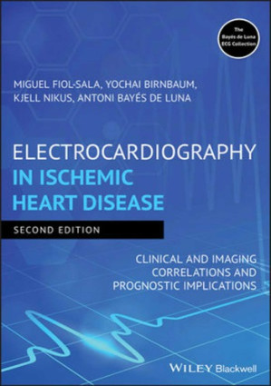 electrocardiography in ischemic heart disease: clinical and imaging correlations and prognostic implications – 2nd edition