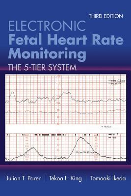 electronic fetal heart rate monitoring: the 5 tier system: the 5 tier system 3rd edition