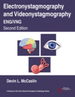 electronystagmography and videonystagmography (eng/vng), second edition
