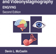 electronystagmography and videonystagmography (eng/vng), second edition